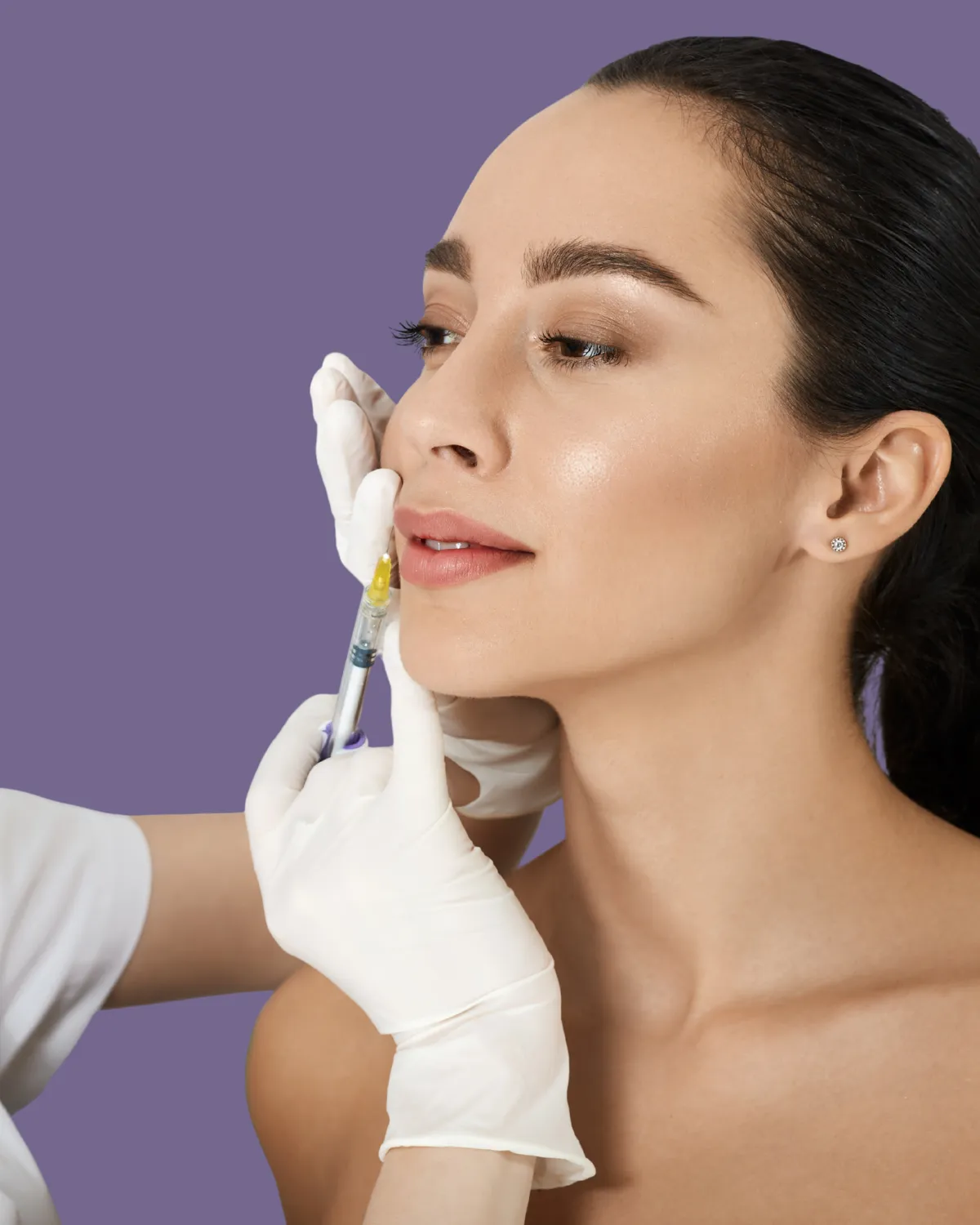 Woman showing lifted lips after facial plastic surgery.