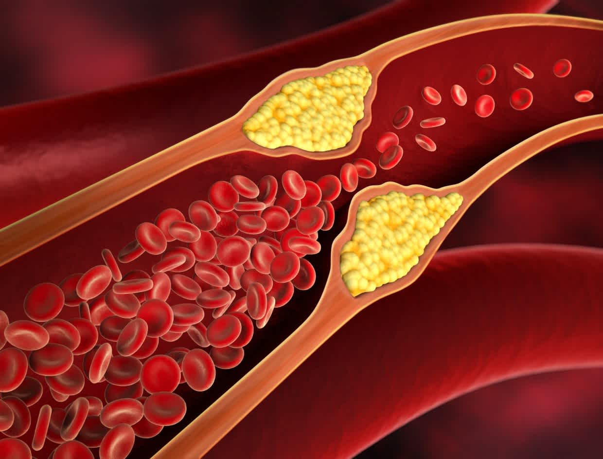 The confusion around cholesterol — and a broader perspective worth considering