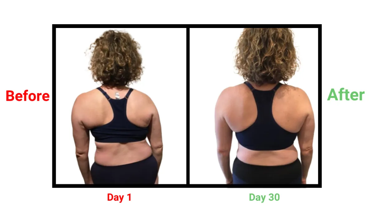 Video thumbnail for scoliosis protocol overview