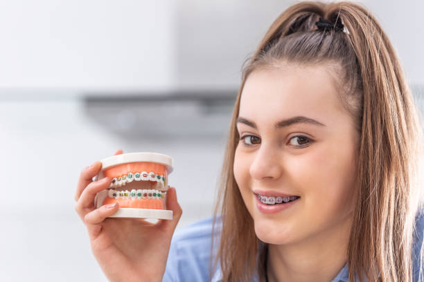 Braces Care Tips For Daily Cleaning, Comfort, And Faster Results