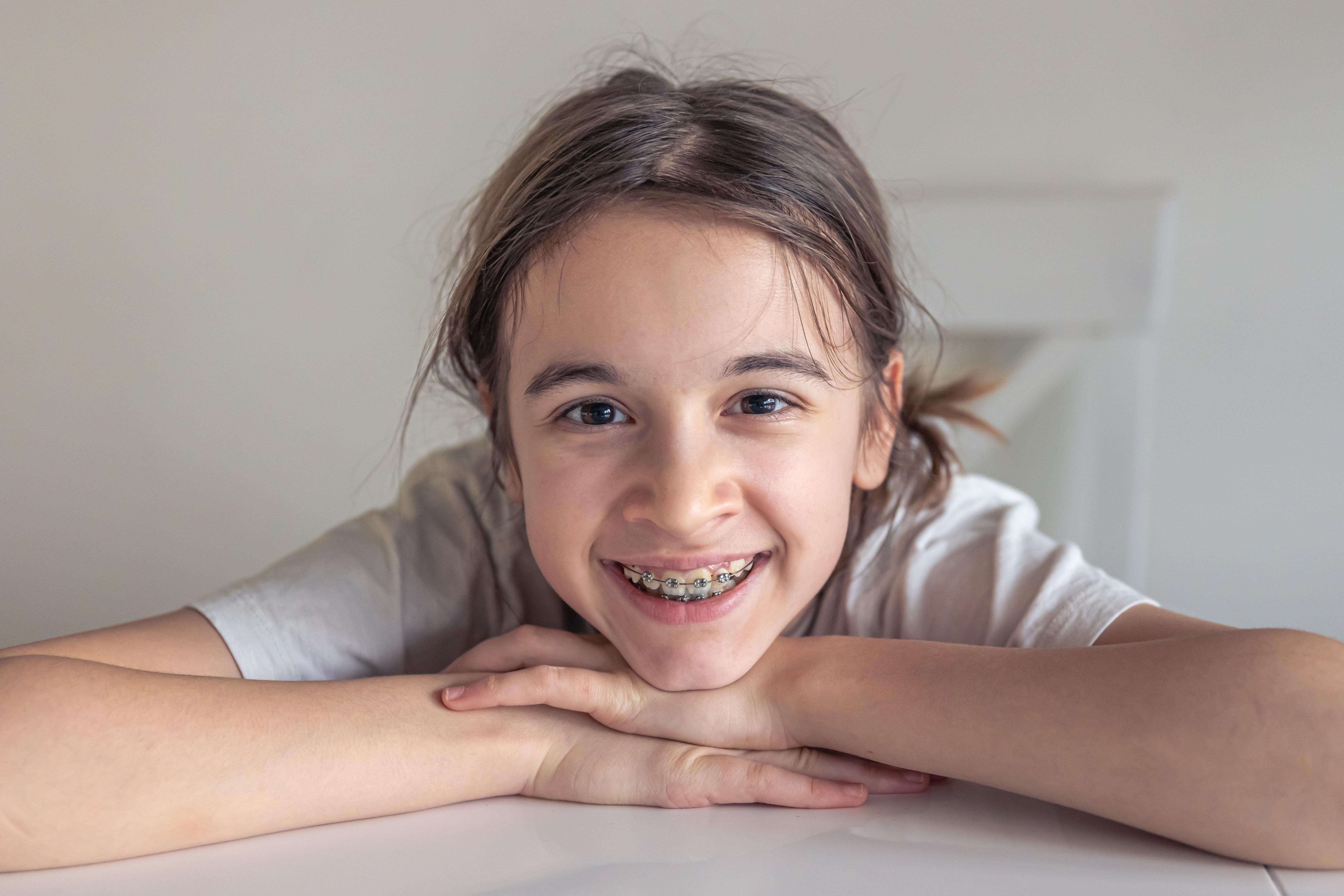 What Are Braces? Everything You Need to Know