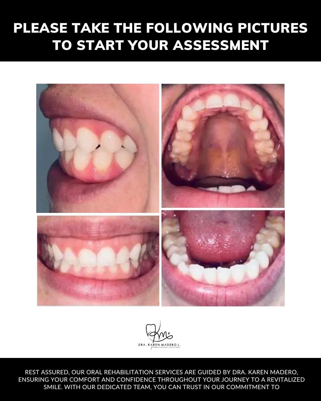 To begin your evaluation and receive a consultation, please submit your contact information using the form on the right. Afterward, you can easily upload your photos for our review.  Alternatively, you can send your photos and information directly to us via WhatsApp.