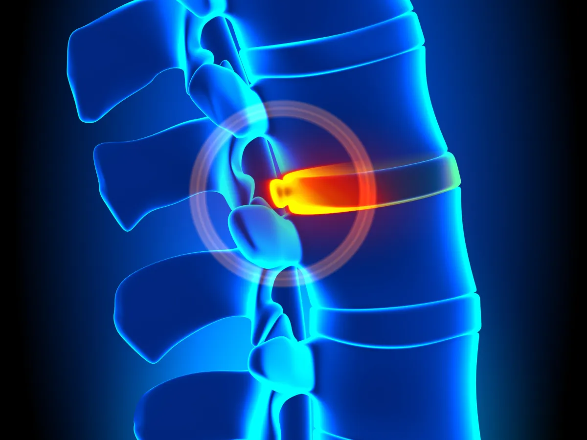 spine in need of chiropractic care