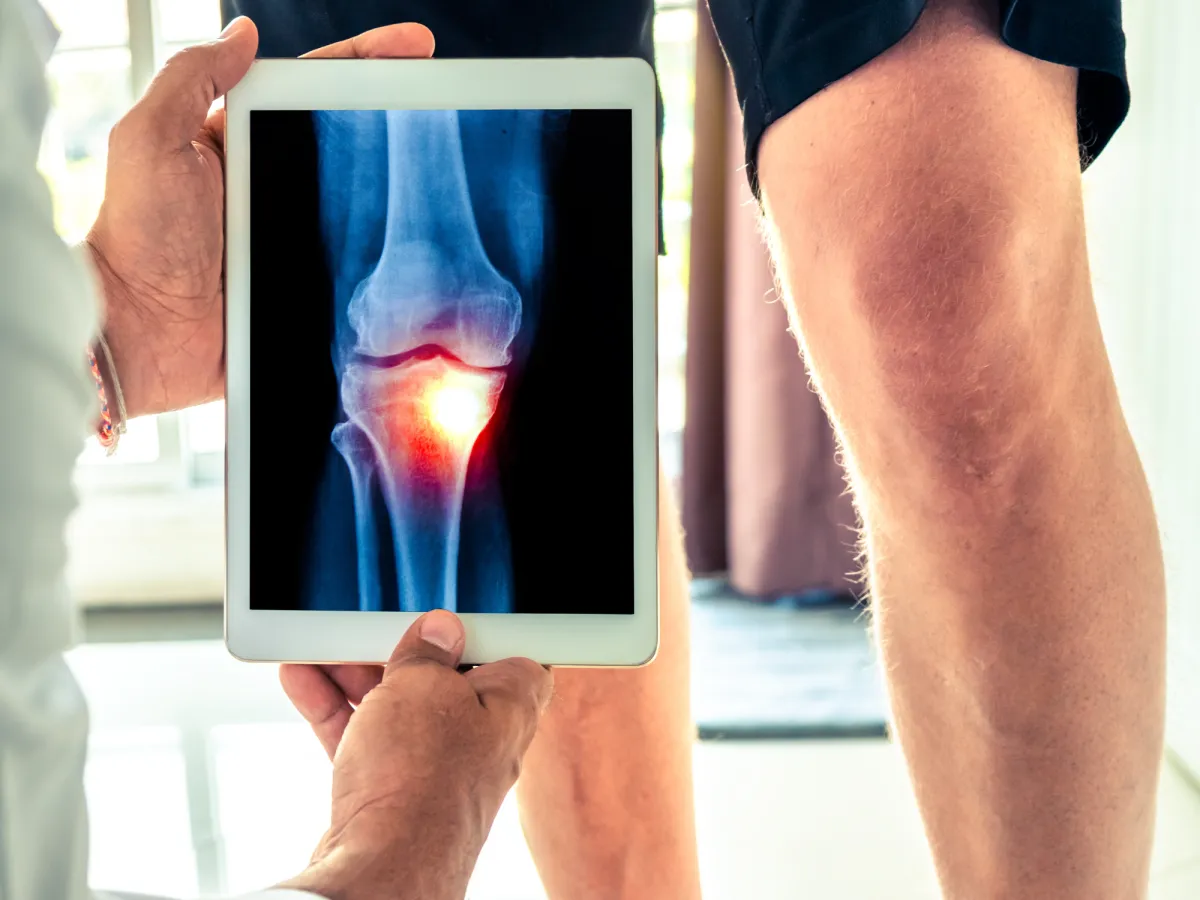 Patient with knee pain