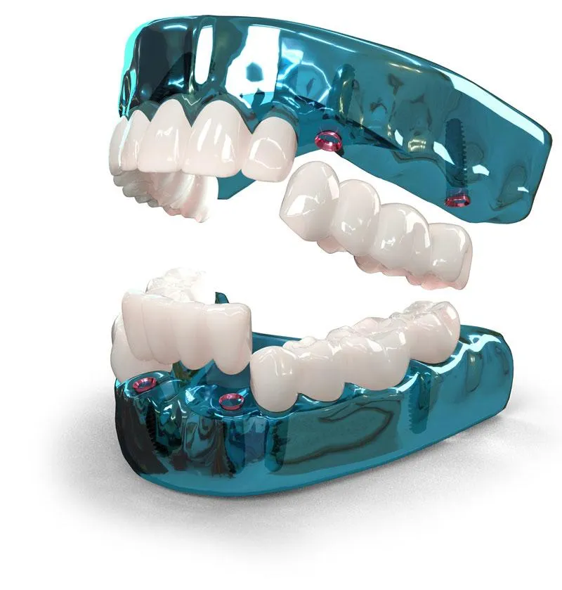 3 on 6 dental model