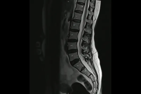 Your MRI Is Normal. So Why Do You Still Feel Like This?