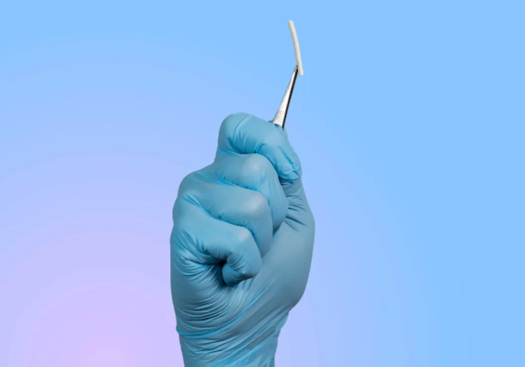 Contraceptive implant held