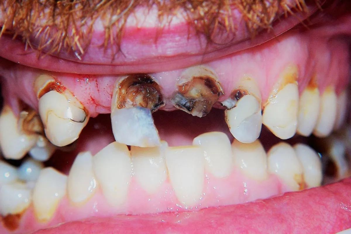 Before dental treatment