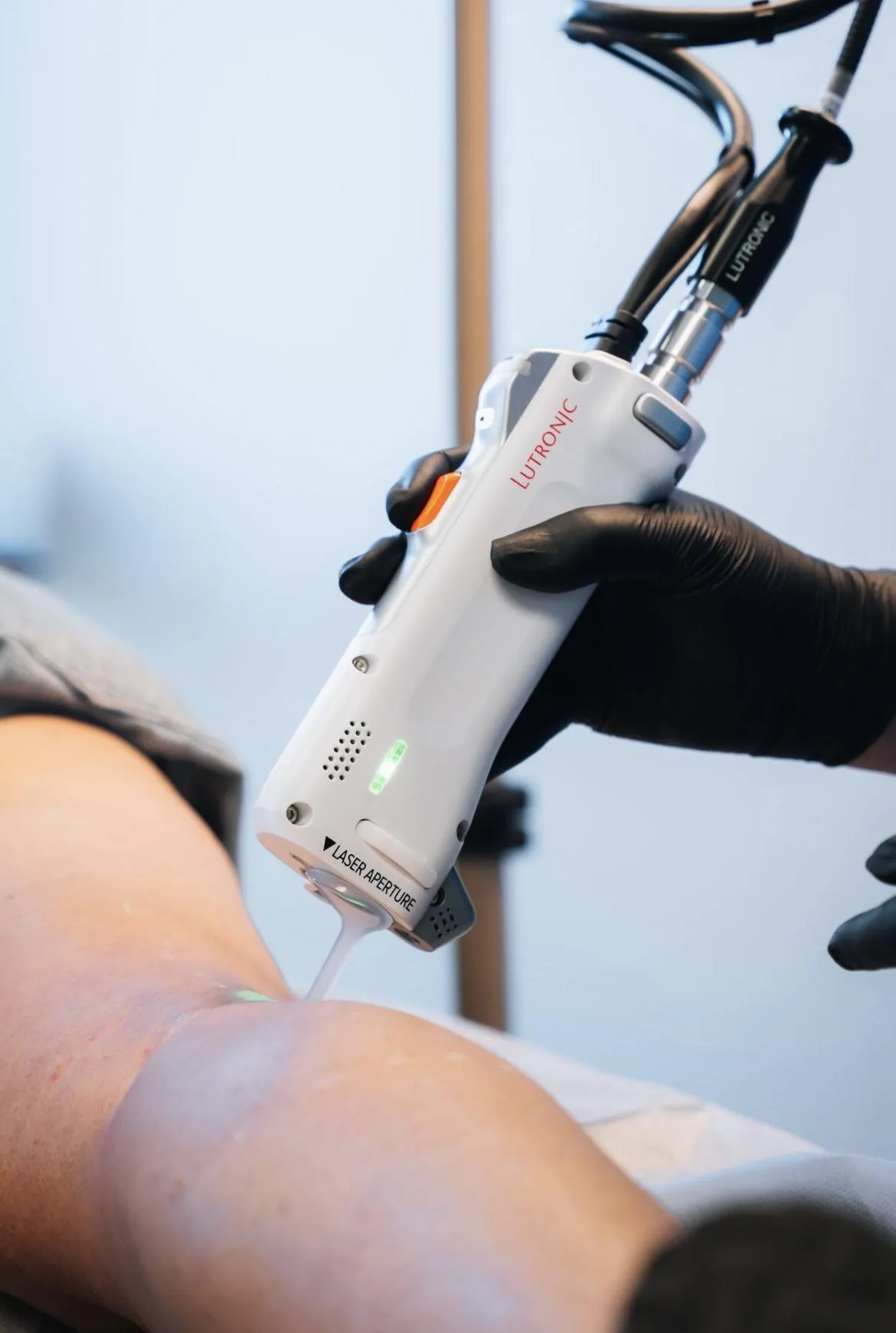 a close up of a person's back with brown spots