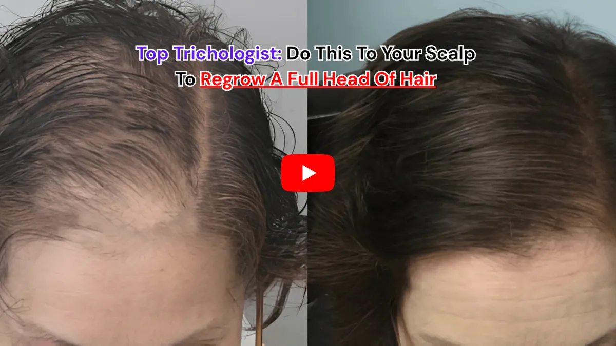 Folicrex Hair Regrowth Supplement