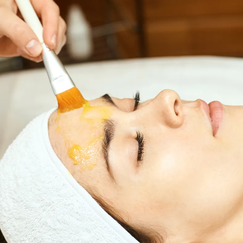 Chemical Peels