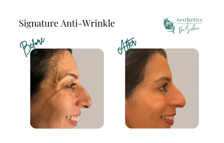 a large cloud is in the sky above a mountain