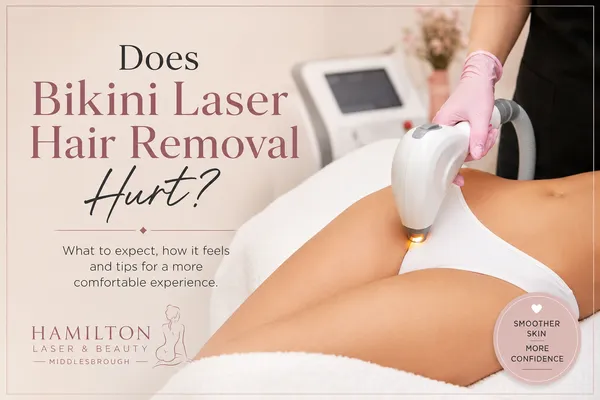 Bikini laser hair removal treatment showing laser device being used on the bikini area