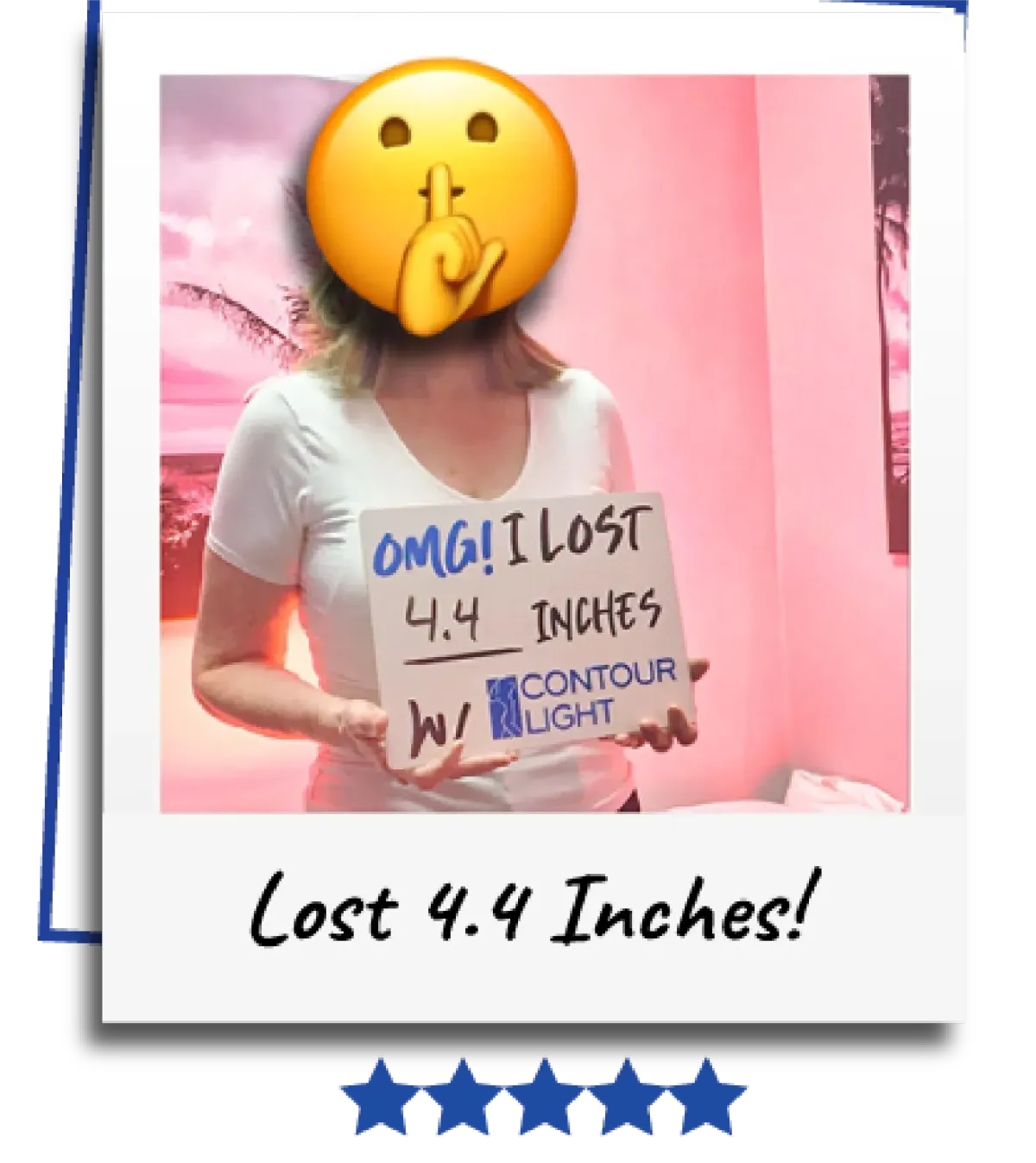 Body sculpting before and after results Clifton NJ