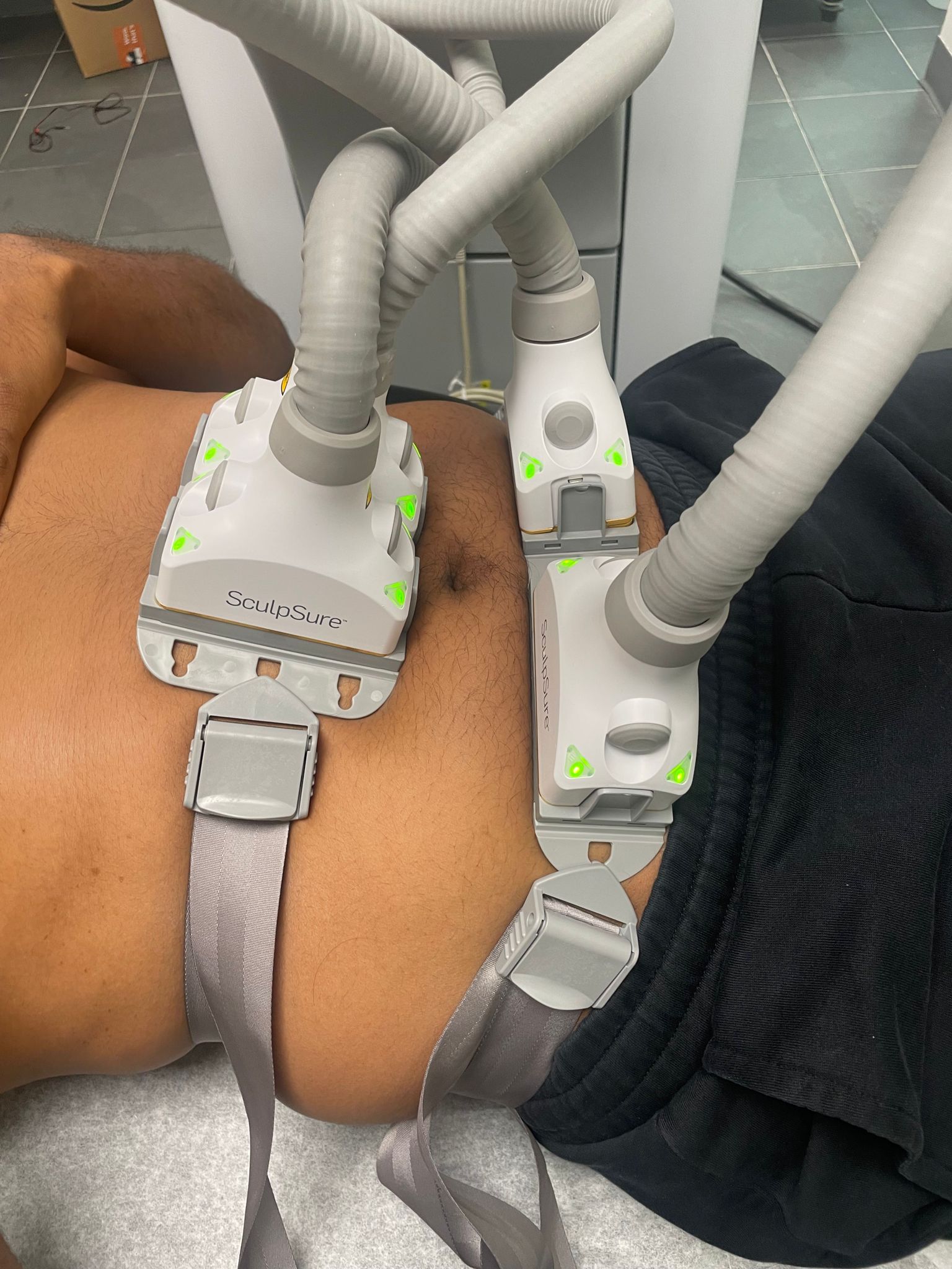 SculpSure fat reduction treatment at Transformative 360 Clifton NJ