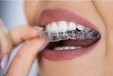 Woman holding clear aligner tray for teeth straightening