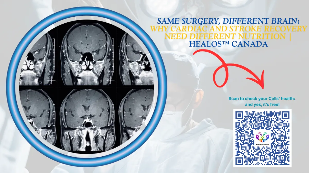 cardiac vs stroke recovery, Alpha-GPC stroke protocol, post-surgical cellular nutrition, blood-brain barrier IRI, Healos™ precision protocols