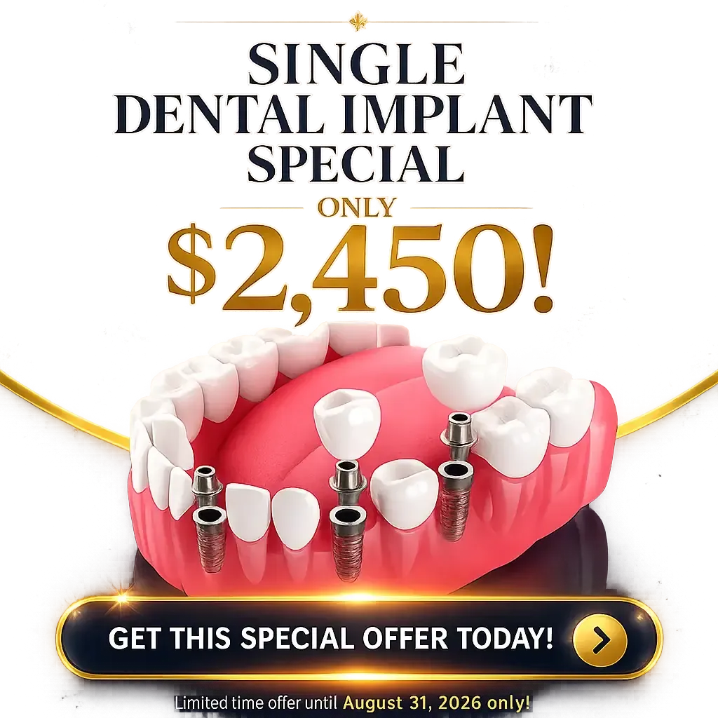 Single Dental Implant in Las Vegas
