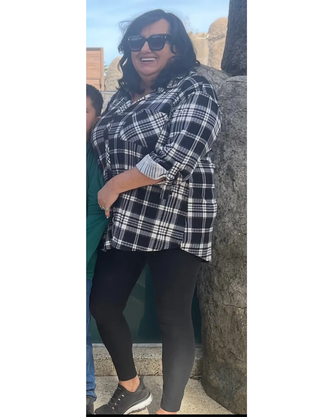 Before treatment transformation