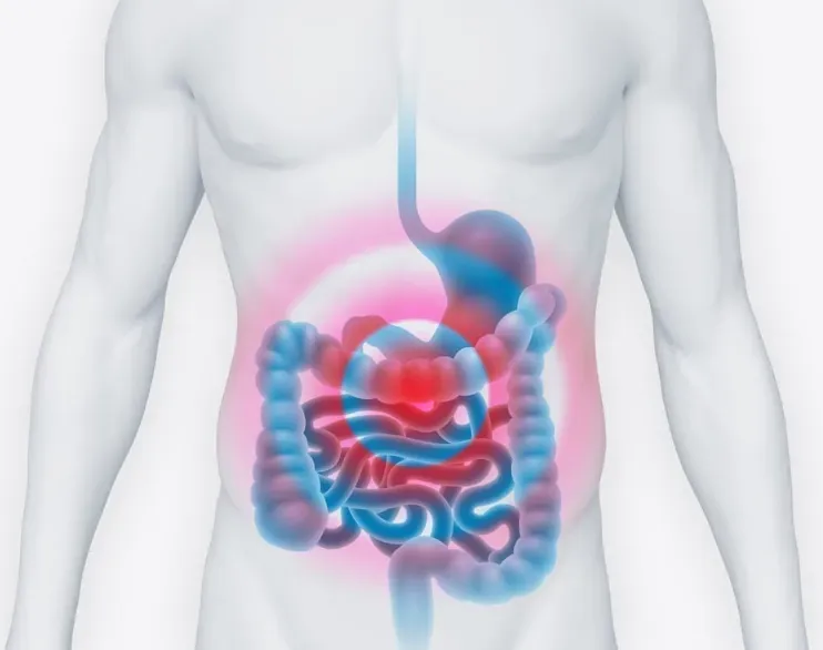 Representación clínica del intestino y microbioma equilibrado