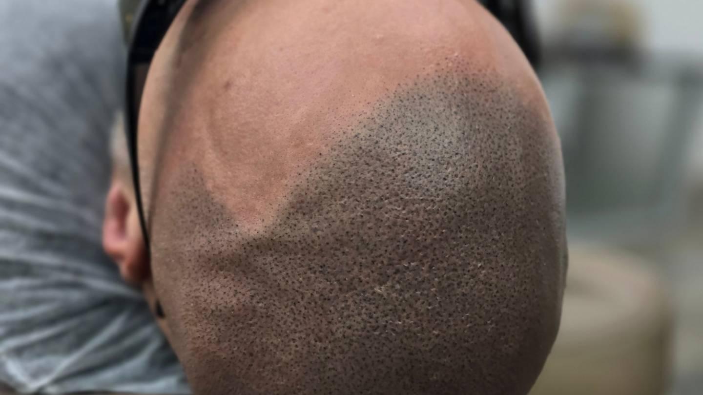 black and white snake on yellow background