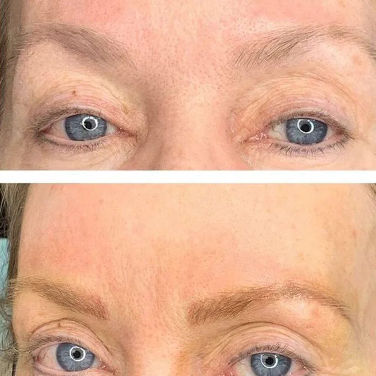Permanent Eyebrows 