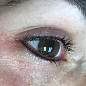 Eyeliner Tattooing by Robin Hays