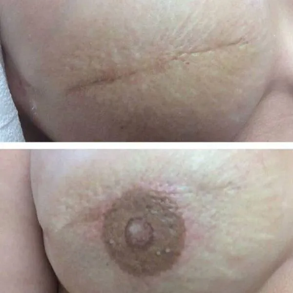 Nipple Tattoo by Robin Hays