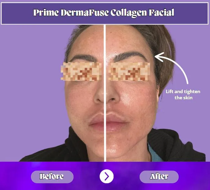 Prime Vitality’s signature facial for radiant, youthful skin in San Antonio, TX.
