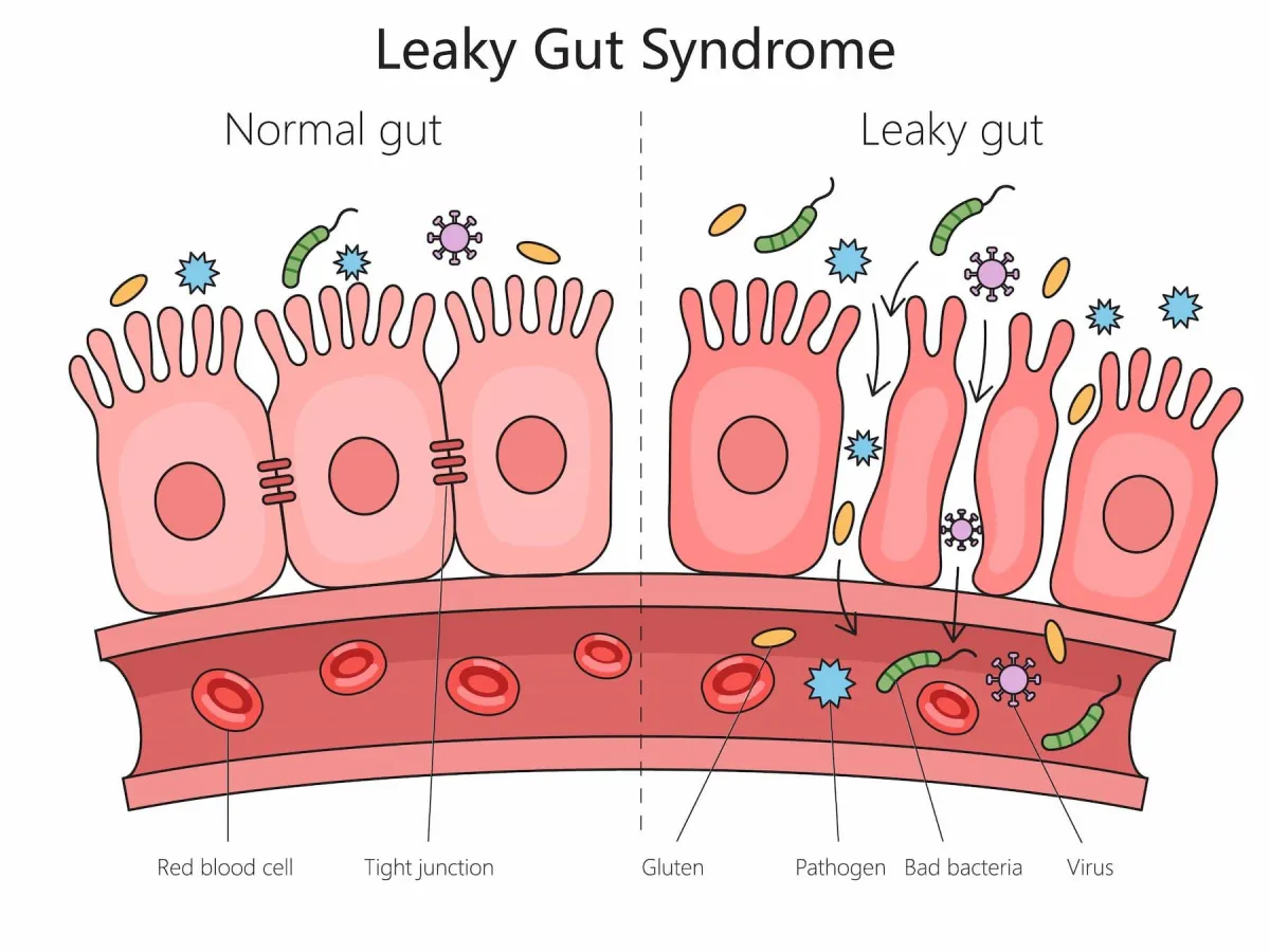 Holistic Weight Loss Elite Sexual Hormone Health