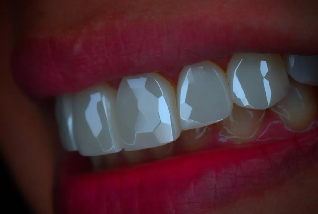 a woman getting her teeth brushed by a dentist