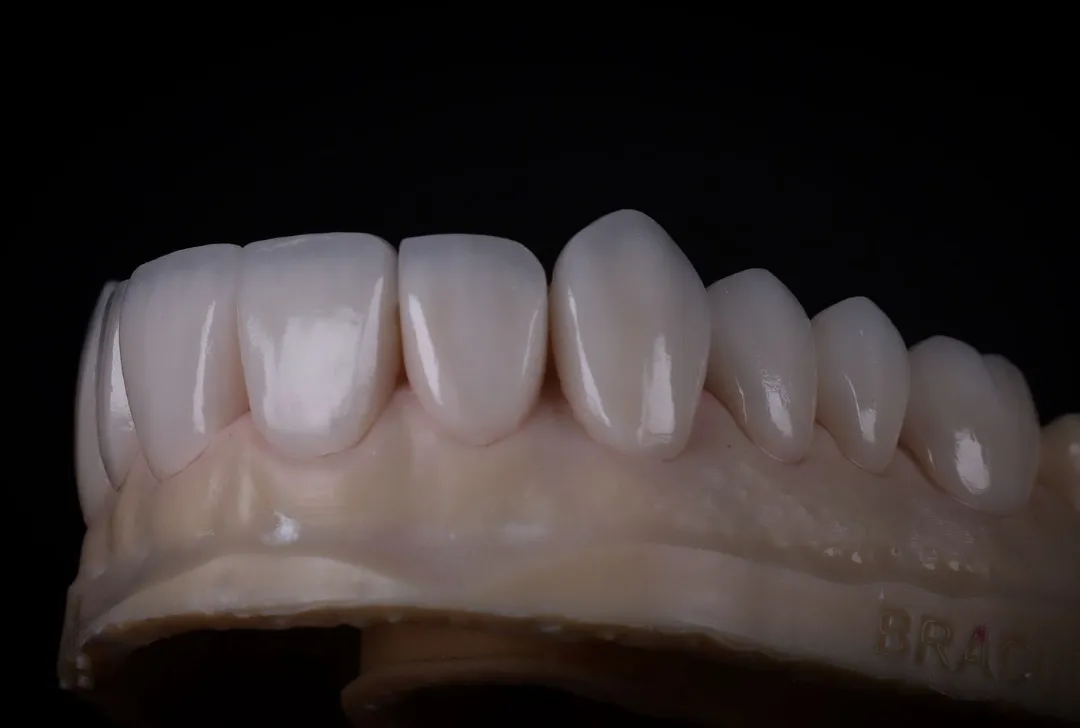 Dentist examining a young girl's teeth