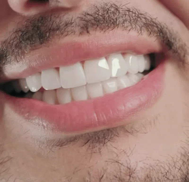 Dentist examining a patient's teeth in a clinic.