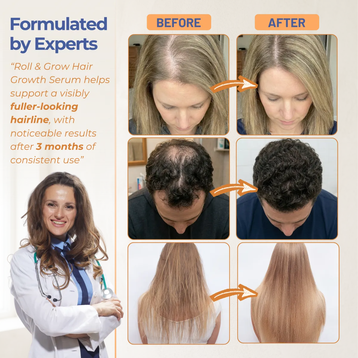 Roll & Grow serum — in use