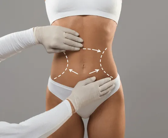 Body Contouring