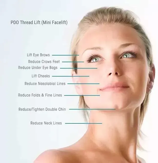 restorative health- PDO thread lift