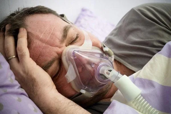 sleep apnea treatment, millceek