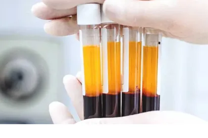 Alternative Laser CO2 Sibiu