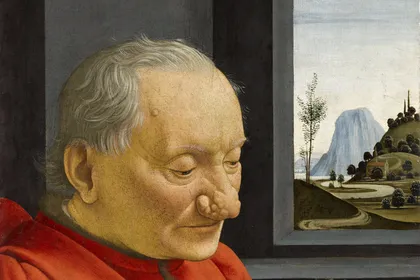 Laser CO2 Textura si pori dilatati