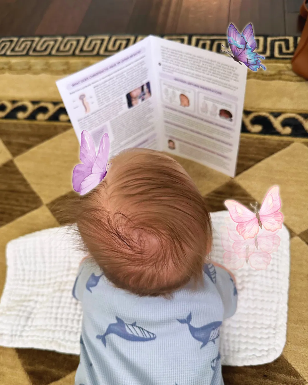 Baby reading Dr. Keila's Infant Cranial Brochure