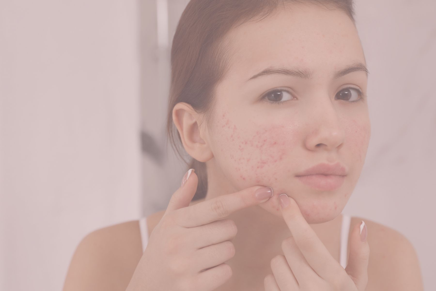 PCOS / PMOS Skin Care Tips: How to Support Hormonal Acne, Oiliness & Dark Patches Naturally
