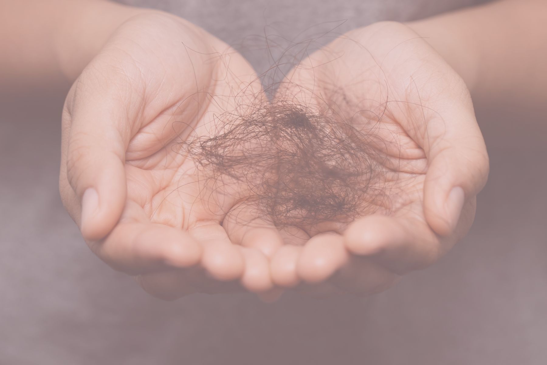 PCOS Hair Loss Blood Tests: What to Check (and Why “Everything Looks Normal” Isn’t Always the Full Story)