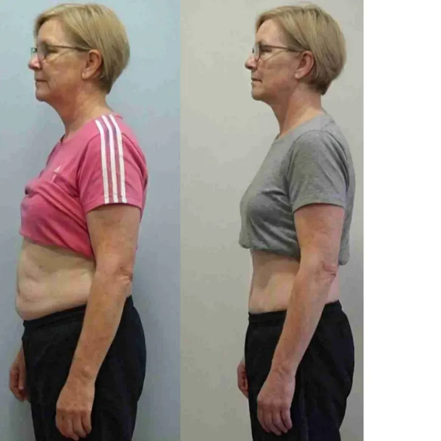 Client transformation result for the Logic & Limbic weight loss program