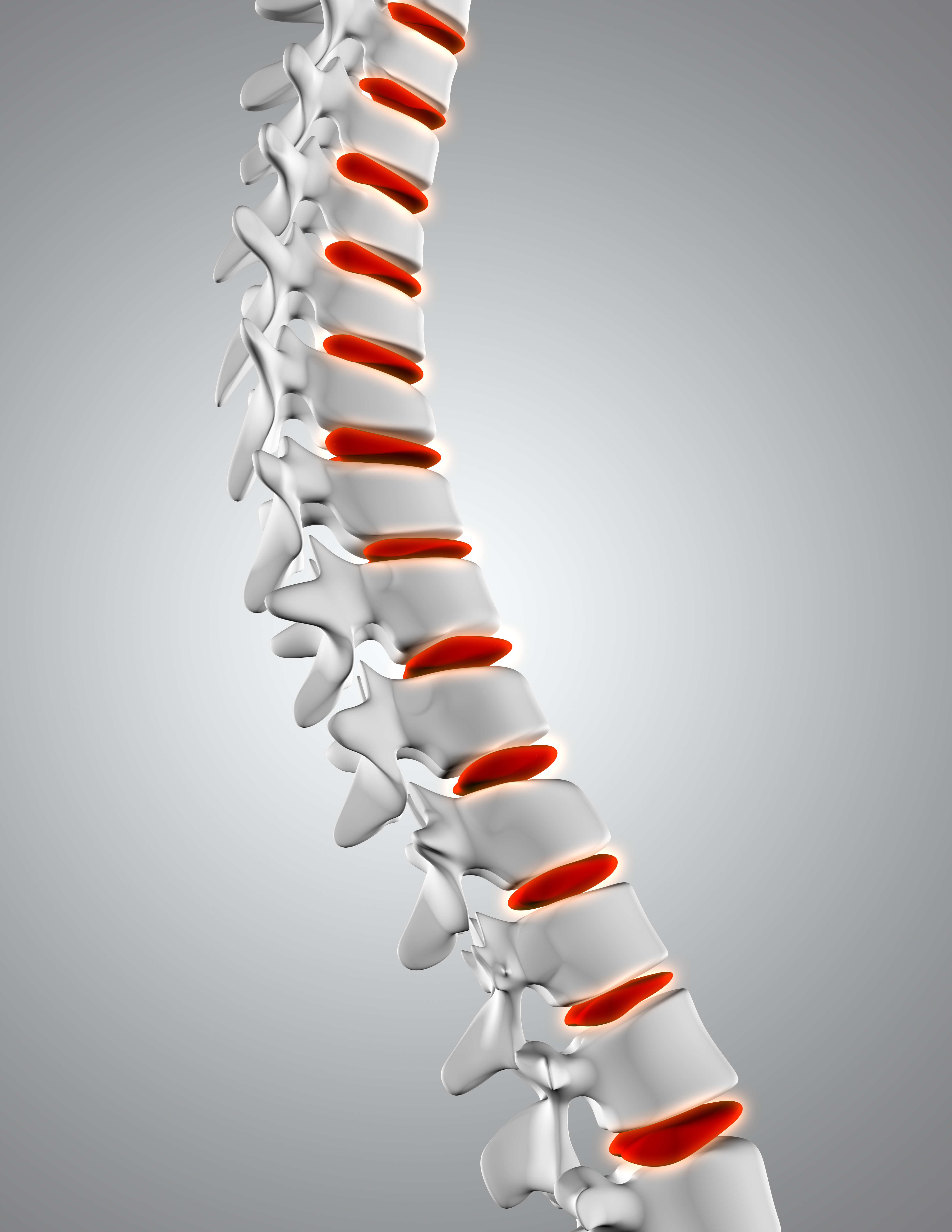 High-contrast image of a patient undergoing comfortable, non-surgical spinal decompression therapy on a specialized treatment table