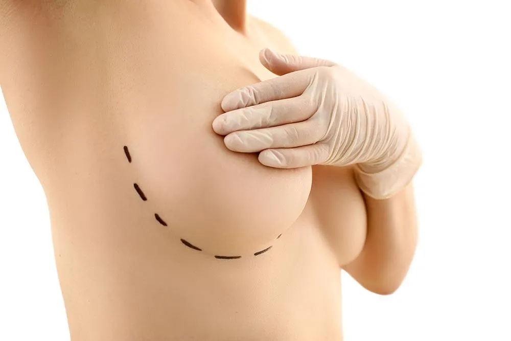 Swimwear after breast augmentation in burlington