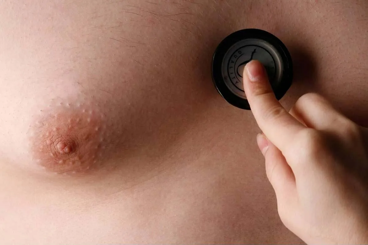breast augmentation before and after