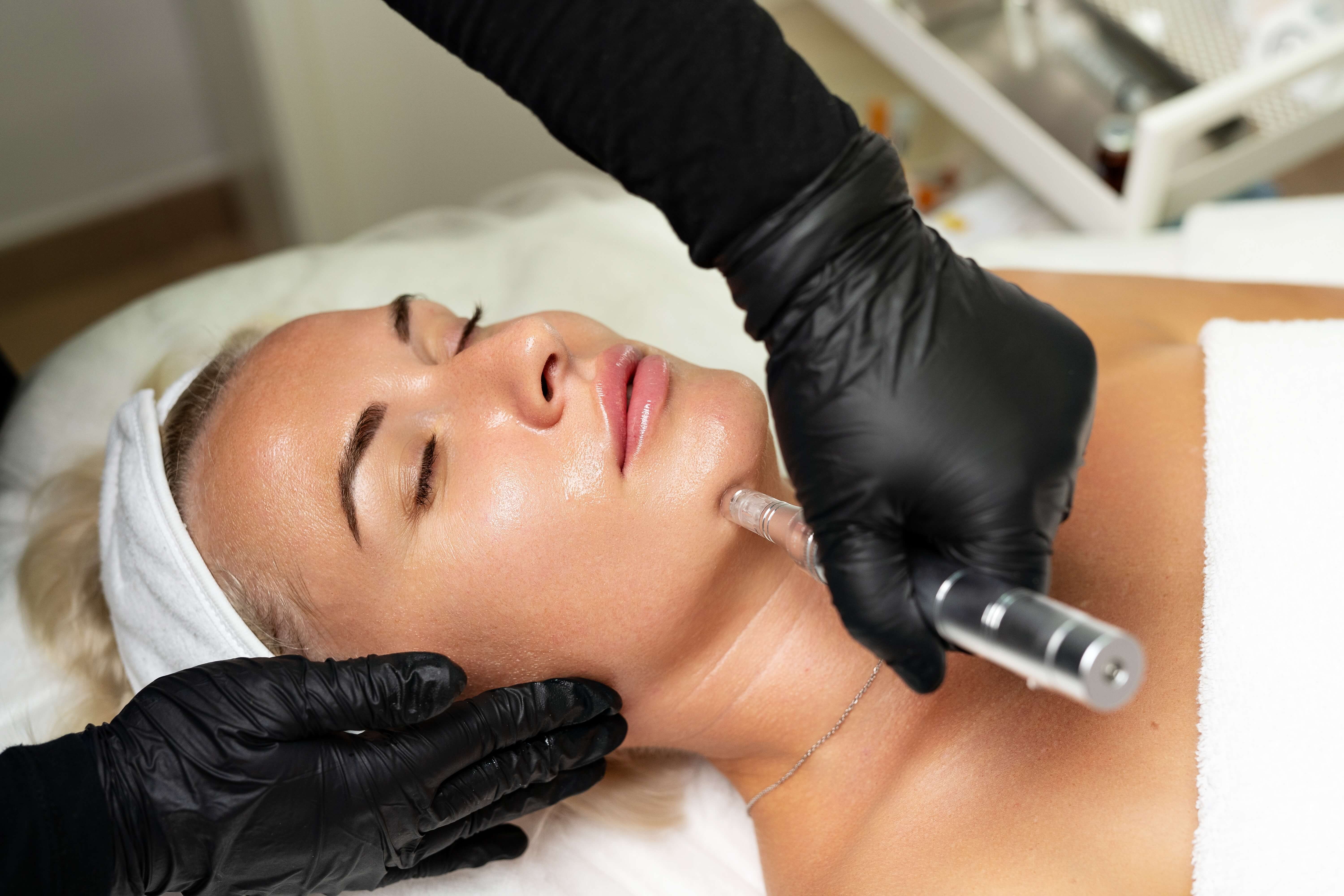 Microneedling: One Of The Hottest Skin Health Trends In Brentwood TN!