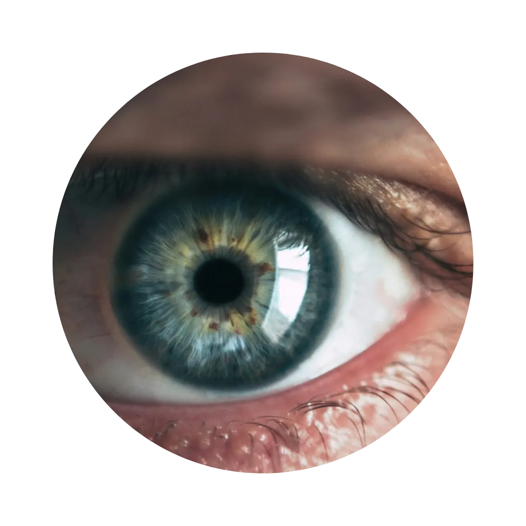 Iridology Report