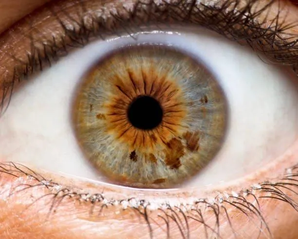 Iridology