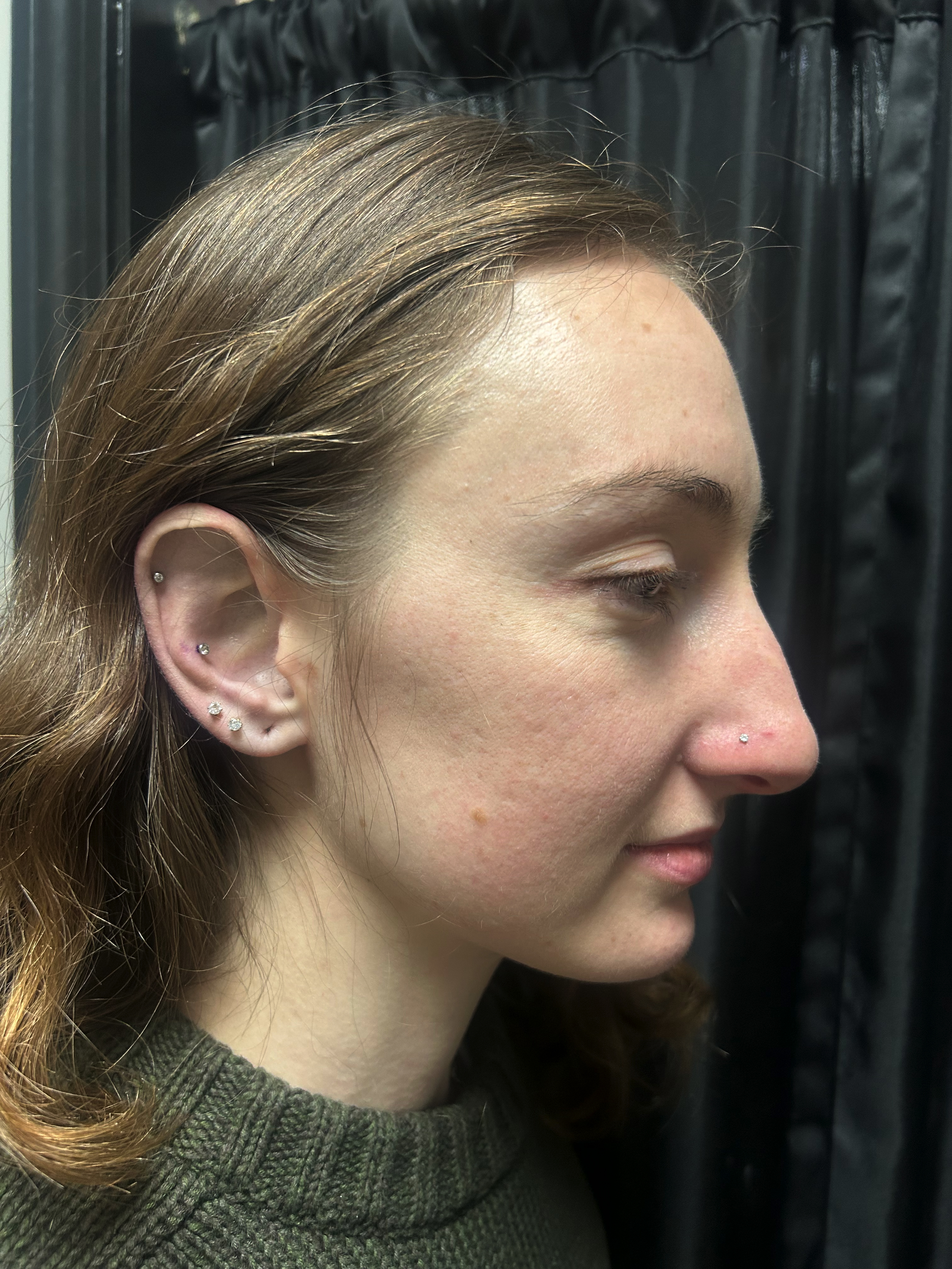 Conch and Cartilage Piercings
